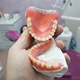 Prótesis Dental