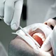 Cirugía Oral