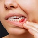 Periodoncia